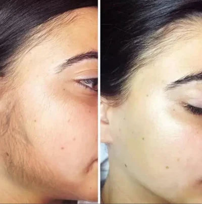 Cyperus Rotundus Oil