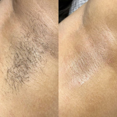 Cyperus Rotundus Oil